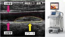 超音波画像診断